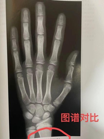 测骨龄疑云：董路早前言论，宝库为何跟进？